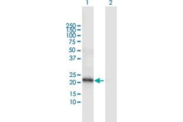 DCAKD antibody  (AA 1-231)