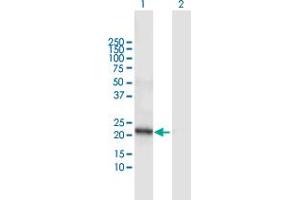 DCAKD antibody  (AA 1-231)