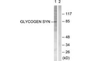 Image no. 1 for anti-Glycogen Synthase 1 (Muscle) (GYS1) (AA 621-670) antibody (ABIN2888631)