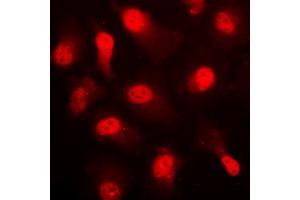 Immunofluorescent analysis of AMPK alpha 1 (pS496) staining in HUVEC cells.