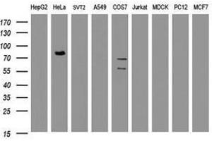 Image no. 2 for anti-HBS1-Like (HBS1L) (AA 1-242) antibody (ABIN1490627)
