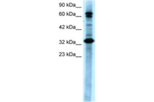 Image no. 1 for anti-TGF-beta Activated Kinase 1/MAP3K7 Binding Protein 2 (TAB2) antibody (ABIN2460457)
