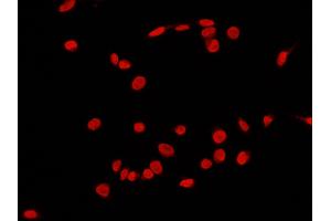Image no. 2 for anti-c-Fos (c-Fos) (N-Term) antibody (ABIN2682008)