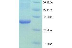 Image no. 1 for Heterogeneous Nuclear Ribonucleoprotein L (HNRNPL) (AA 89-335), (partial) protein (His tag) (ABIN5713508)