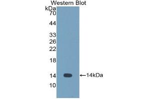 CSTL1 anticorps  (AA 21-114)