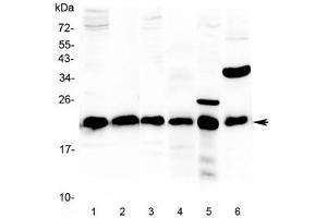 Image no. 1 for anti-Parkinson Protein 7 (PARK7) antibody (ABIN5647859)