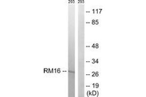Image no. 1 for anti-Mitochondrial Ribosomal Protein L16 (MRPL16) (AA 171-220) antibody (ABIN1534521)