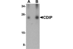 Image no. 2 for anti-LITAF-Like Protein (CDIP1) (Center) antibody (ABIN499607)