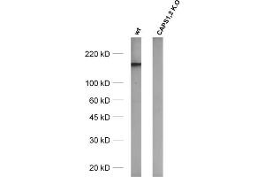 Image no. 1 for anti-Ca++-Dependent Secretion Activator (CADPS) (AA 18-107) antibody (ABIN1742520)
