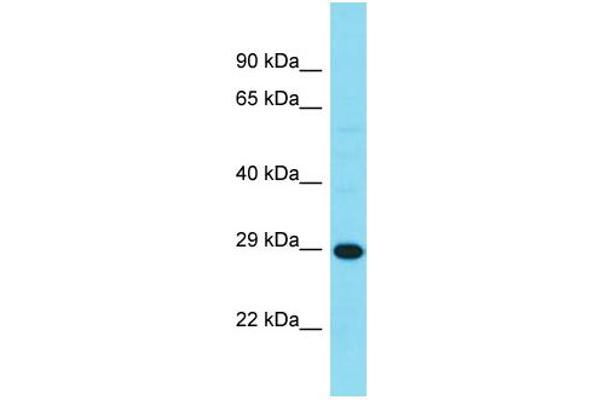 HDHD3 Antikörper  (C-Term)