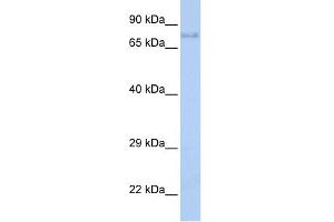 Image no. 3 for anti-Insulin-Like Growth Factor 1 Receptor (IGF1R) (Middle Region) antibody (ABIN2792087)