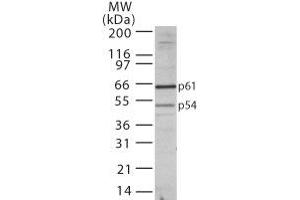 Image no. 1 for anti-Transducin (Beta)-Like 1 X-Linked Receptor 1 (TBL1XR1) (AA 200-250) antibody (ABIN208530)