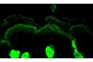 Image no. 4 for anti-Calreticulin (CALR) antibody (HRP) (ABIN2486726)