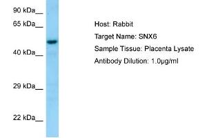 Image no. 1 for anti-Sorting Nexin 6 (SNX6) (C-Term) antibody (ABIN2790093)