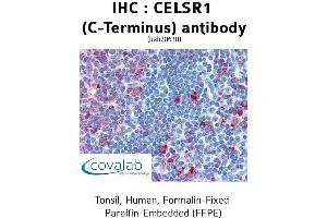 Image no. 1 for anti-Cadherin EGF LAG Seven Pass G-Type Receptor 1 (CELSR1) (C-Term) antibody (ABIN1732965)