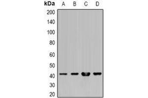 Image no. 2 for anti-Major Histocompatibility Complex, Class I, A (HLA-A) (full length) antibody (ABIN6004996)