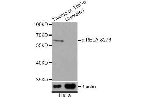 Image no. 4 for anti-Nuclear Factor-kB p65 (NFkBP65) (pSer276) antibody (ABIN1682005)