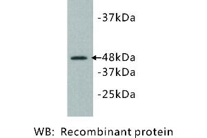 Image no. 1 for anti-Kinase D-Interacting Substrate, 220kDa (KIDINS220) antibody (ABIN1112816)