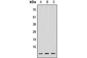 Image no. 2 for anti-NADH Dehydrogenase (Ubiquinone) Flavoprotein 3, 10kDa (NDUFV3) (Center) antibody (ABIN2706664)