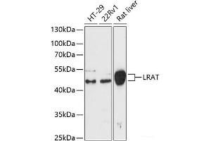 Western blot analysis of extracts of various cell lines using LRat Polyclonal Antibody at dilution of 1:3000.