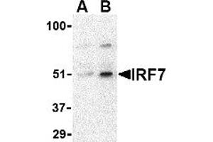 Western Blotting (WB) image for anti-Interferon Regulatory Factor 7 (IRF7) (Middle Region) antibody (ABIN1030964)