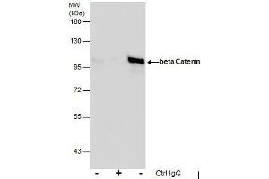 Immunoprecipitation (IP) image for anti-Catenin (Cadherin-Associated Protein), beta 1, 88kDa (CTNNB1) (N-Term) antibody (ABIN2855042)