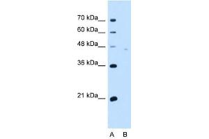 Image no. 2 for anti-Neuroplastin (NPTN) (Middle Region) antibody (ABIN630447)