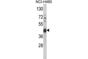 Image no. 3 for anti-Protein Kinase A, alpha (PRKACA) antibody (ABIN3002818)