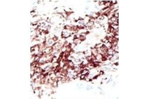 Image no. 1 for anti-Histone Deacetylase 11 (HDAC11) (N-Term) antibody (ABIN356659)
