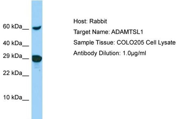 anti-ADAMTS-Like 1 (ADAMTSL1) (N-Term) antibody