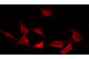 Image no. 1 for anti-Protein Kinase C, delta (PKCd) (pTyr64) antibody (ABIN6256779)