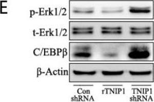 TNIP1 modulates the proliferation of keratinocytes by targeting Erk1/2 and C/EBPβ.