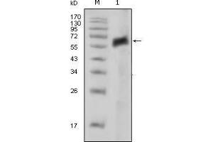 Image no. 2 for anti-AXL Receptor tyrosine Kinase (AXL) antibody (ABIN968974)