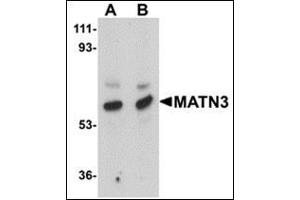 Image no. 1 for anti-Matrilin 3 (MATN3) (Center) antibody (ABIN500246)