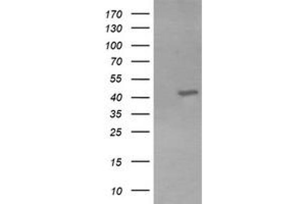 anti-Potassium Voltage-Gated Channel, Shaker-Related Subfamily, beta Member 1 (KCNAB1) antibody