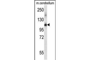 Image no. 1 for anti-Serine/threonine-Protein Kinase PRP4 Homolog (PRPF4B) (AA 180-207), (N-Term) antibody (ABIN5534622)