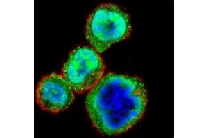 Image no. 2 for anti-Retinoblastoma Protein (Rb Protein) (AA 586-615) antibody (ABIN3032465)
