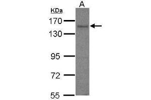 WB Image Sample (30 ug of whole cell lysate) A: IMR32 7.