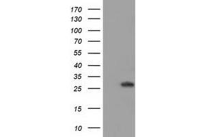 Image no. 2 for anti-Bridging Integrator 3 (BIN3) antibody (ABIN1496923)