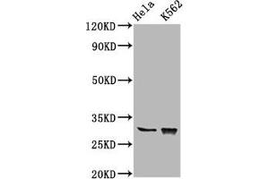 Western Blot Positive WB detected in: Hela whole cell lysate, K562 whole cell lysate All lanes: CHODL antibody at 6.