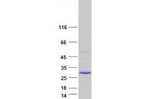 Image no. 1 for Sarcospan (Kras Oncogene-Associated Gene) (SSPN) (Transcript Variant 1) protein (Myc-DYKDDDDK Tag) (ABIN2731402)