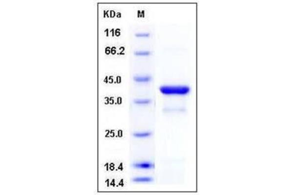 Nuclear Factor of kappa Light Polypeptide Gene Enhancer in B-Cells Inhibitor, alpha (NFKBIA) (AA 2-317) protein (His tag)
