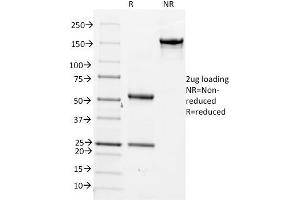 Image no. 1 for anti-Cell Division Cycle 20 Homolog (S. Cerevisiae) (CDC20) antibody (ABIN6941283)