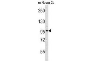 Image no. 1 for anti-Chloride Channel 2 (CLCN2) (AA 208-237), (N-Term) antibody (ABIN951555)
