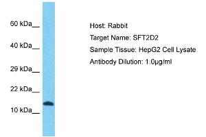Image no. 1 for anti-SFT2 Domain Containing 2 (SFT2D2) (N-Term) antibody (ABIN2791909)