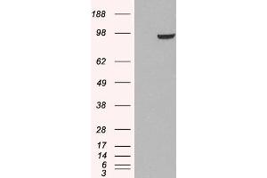Image no. 2 for anti-phosphodiesterase 5A, cGMP-Specific (PDE5A) (C-Term) antibody (ABIN185350)