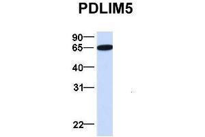 Image no. 3 for anti-PDZ and LIM Domain 5 (PDLIM5) (N-Term) antibody (ABIN2780775)