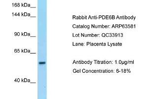 anti-phosphodiesterase 6B, CGMP-Specific, Rod, beta (PDE6B) (N-Term) antibody