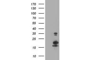 Image no. 7 for anti-LSM1 Homolog, U6 Small Nuclear RNA Associated (LSM1) antibody (ABIN1499210)