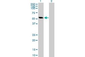 Image no. 1 for anti-Calsequestrin 2 (CASQ2) (AA 1-399) antibody (ABIN514029)